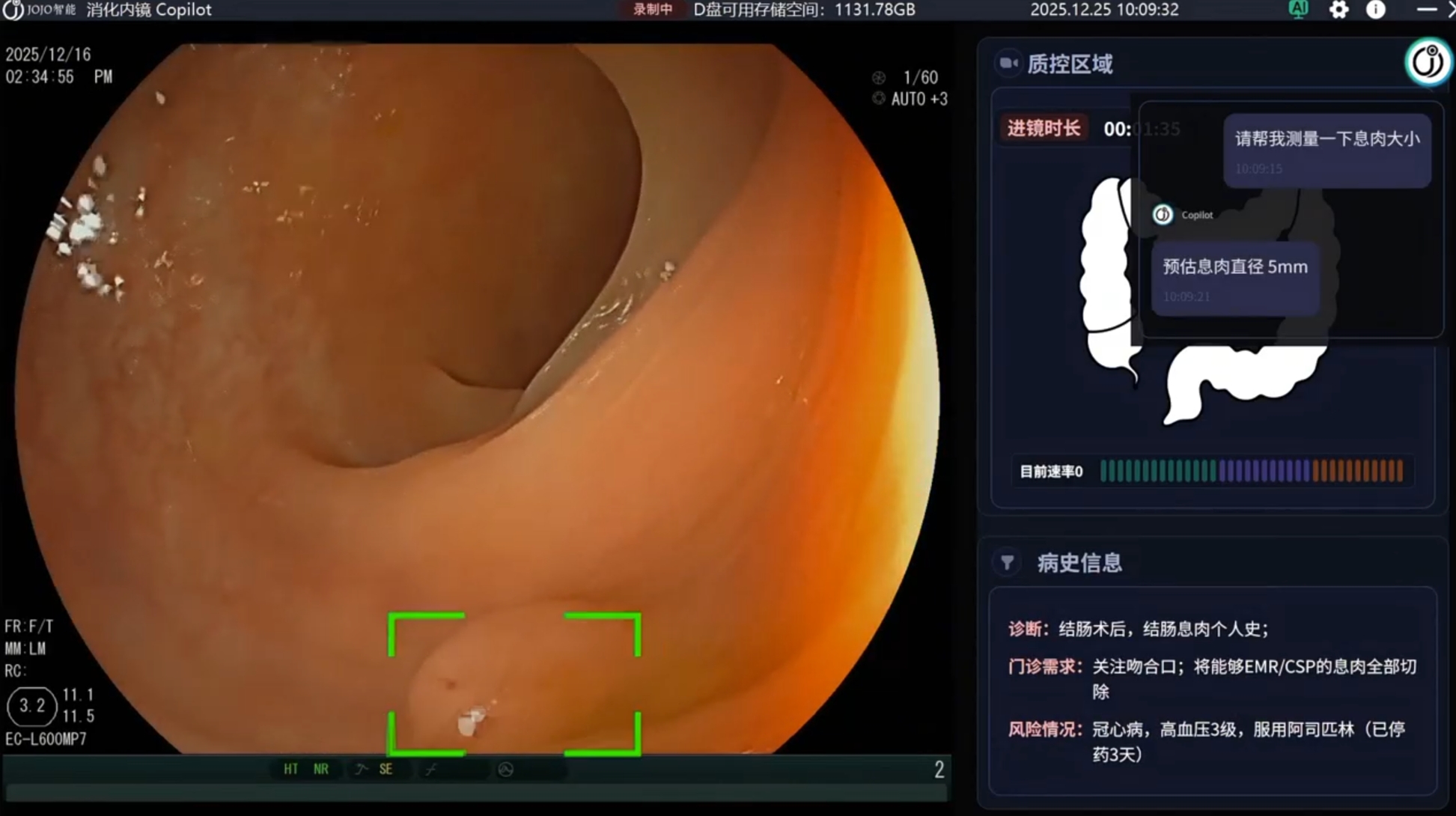 内镜智能体界面 1